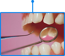 зъбна диагностика