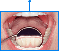 Therapeutical treatment of dental hard tissue